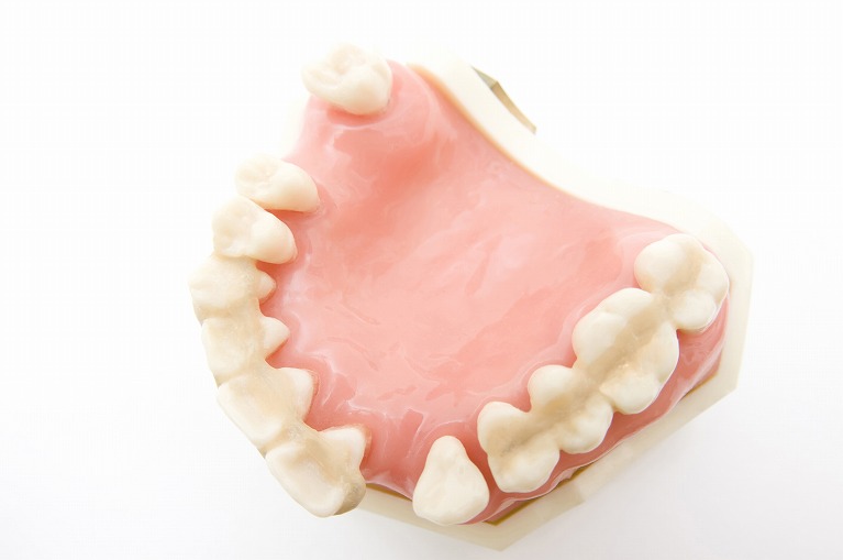 歯を失う原因の第一位は歯周病